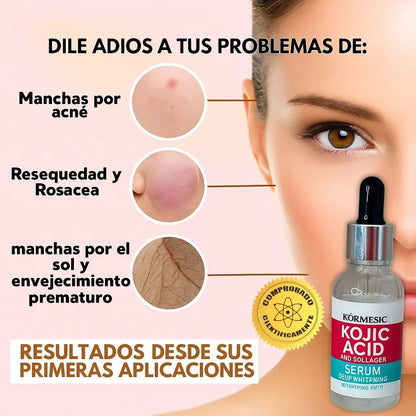 Acido Kojico™